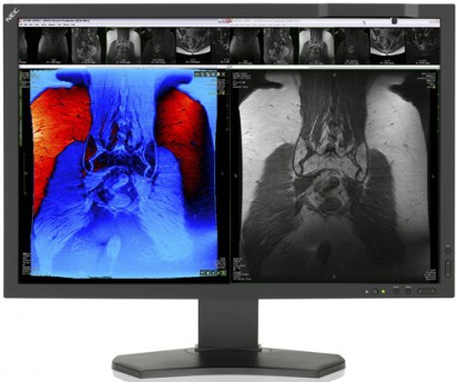nec-md211c3-e-md242c2-display-medicali-1