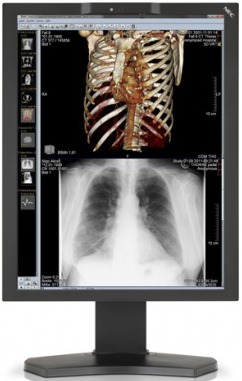 nec-md211c3-e-md242c2-display-medicali-2