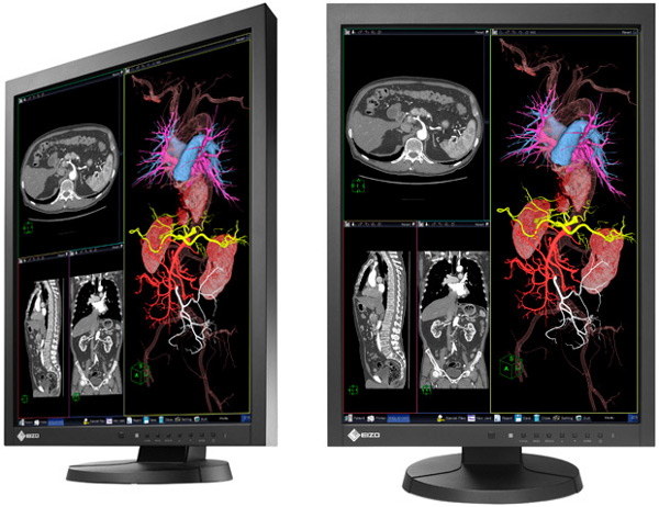 EIZO_RadiForce_MX215