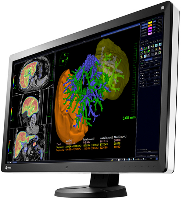 EIZO_RadiForce_RX650
