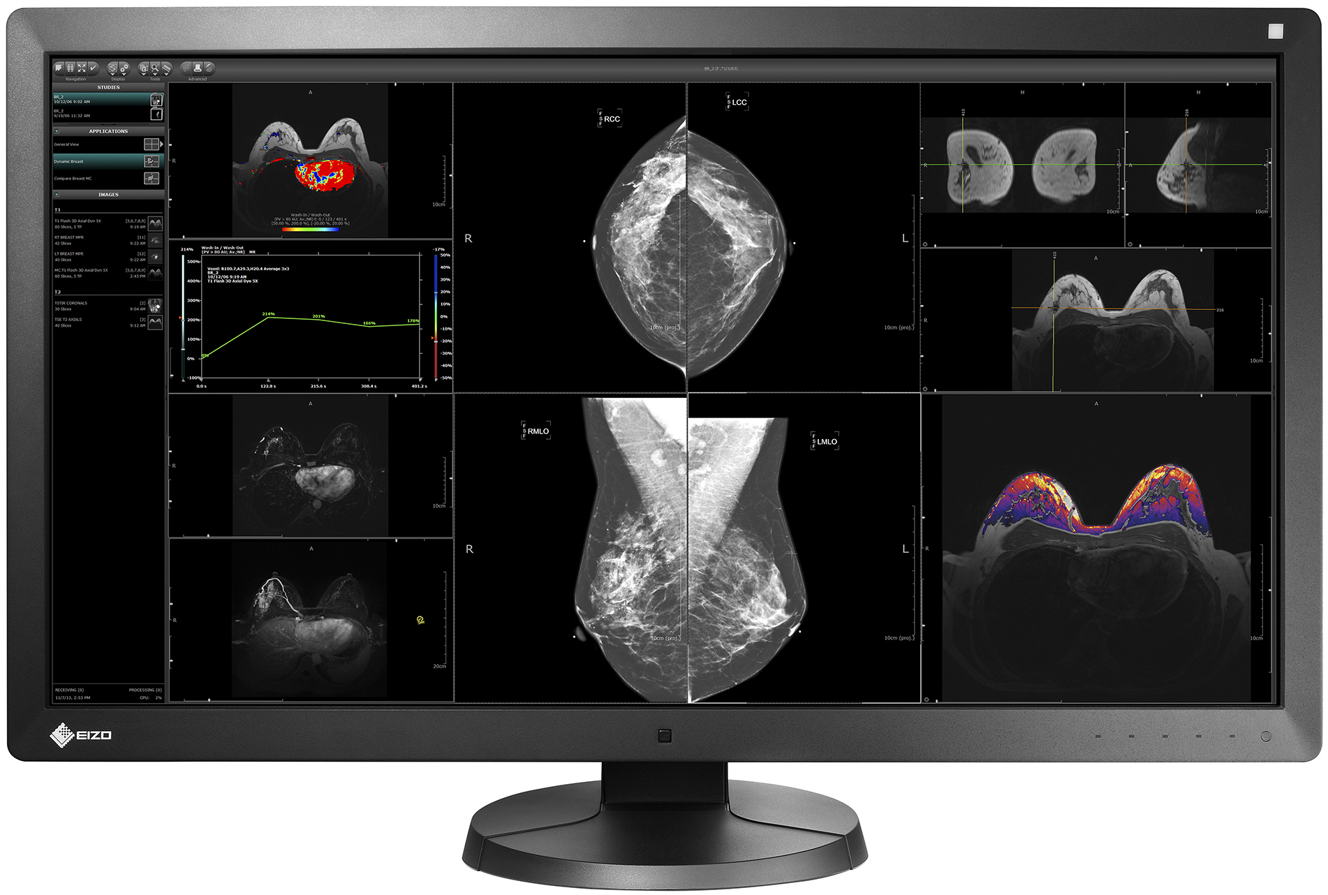 EIZO_RadiForce_RX850