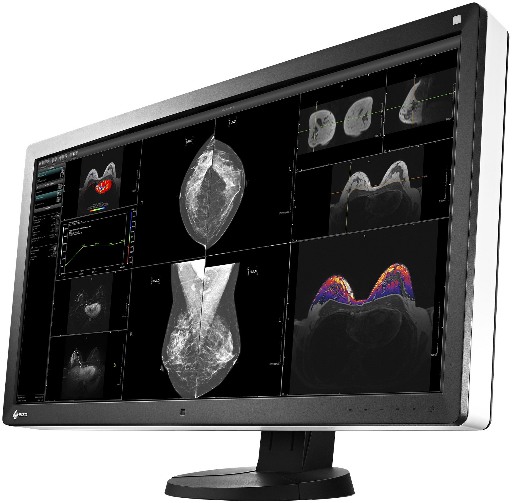 EIZO_RadiForce_RX850_-_1