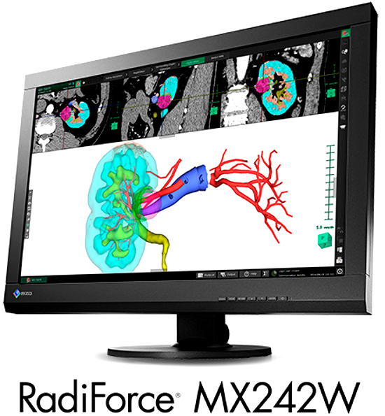 EIZO_RadiForce_MX242W