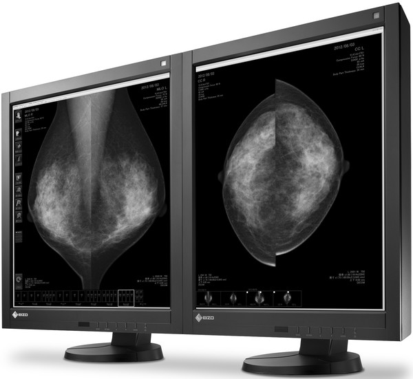 EIZO_RadiForce_GX540